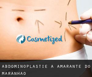 Abdominoplastie à Amarante do Maranhão