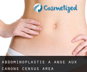 Abdominoplastie à Anse-aux-Canons (census area)