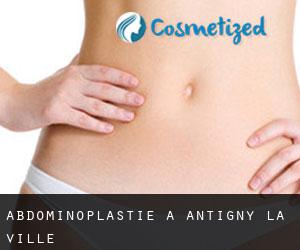 Abdominoplastie à Antigny-la-Ville