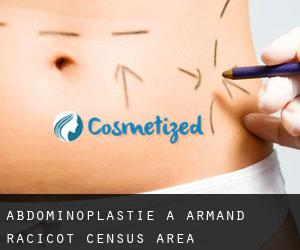 Abdominoplastie à Armand-Racicot (census area)