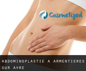Abdominoplastie à Armentières-sur-Avre