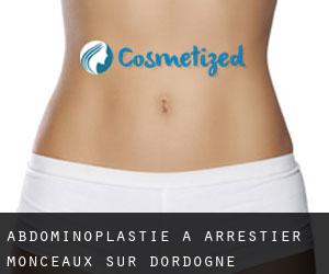 Abdominoplastie à Arrestier, Monceaux-sur-Dordogne