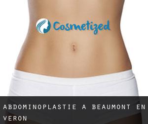 Abdominoplastie à Beaumont-en-Véron
