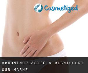 Abdominoplastie à Bignicourt-sur-Marne