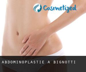 Abdominoplastie à Bignotti