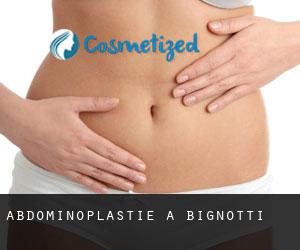 Abdominoplastie à Bignotti