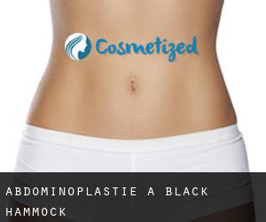 Abdominoplastie à Black Hammock