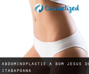 Abdominoplastie à Bom Jesus do Itabapoana