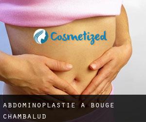 Abdominoplastie à Bougé-Chambalud