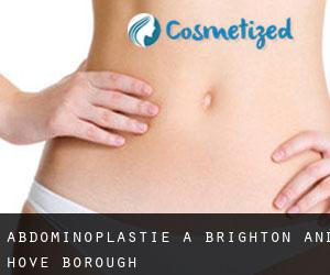 Abdominoplastie à Brighton and Hove (Borough)