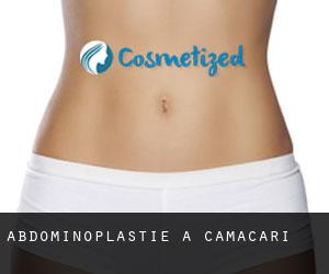 Abdominoplastie à Camaçari