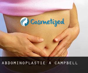 Abdominoplastie à Campbell