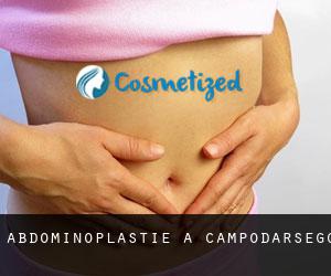 Abdominoplastie à Campodarsego
