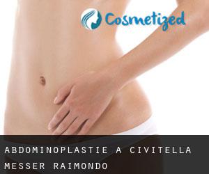 Abdominoplastie à Civitella Messer Raimondo