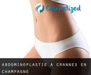 Abdominoplastie à Crannes-en-Champagne