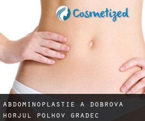 Abdominoplastie à Dobrova-Horjul-Polhov Gradec