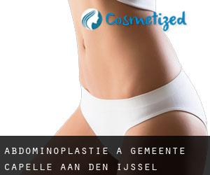 Abdominoplastie à Gemeente Capelle aan den IJssel