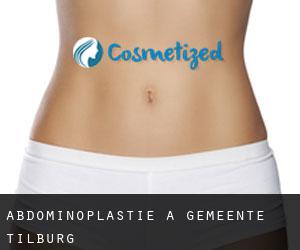 Abdominoplastie à Gemeente Tilburg