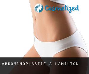 Abdominoplastie à Hamilton Abdominoplastie à Hamilton