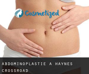 Abdominoplastie à Haynes Crossroad