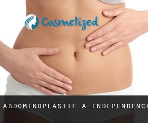 Abdominoplastie à Independence