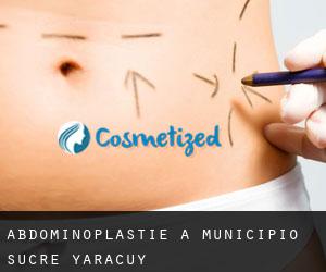 Abdominoplastie à Municipio Sucre (Yaracuy)