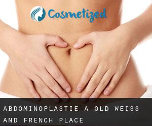 Abdominoplastie à Old Weiss and French Place