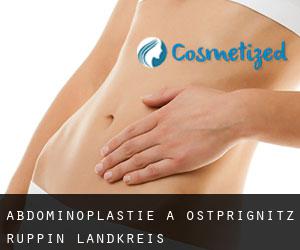 Abdominoplastie à Ostprignitz-Ruppin Landkreis