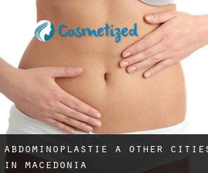 Abdominoplastie à Other Cities in Macedonia
