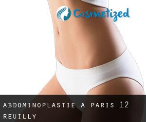 Abdominoplastie à Paris 12 Reuilly