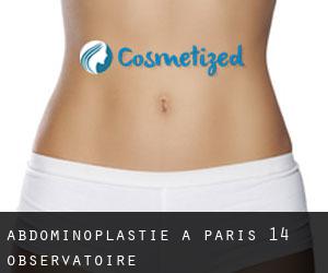 Abdominoplastie à Paris 14 Observatoire