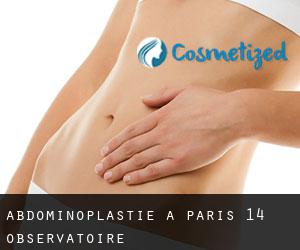 Abdominoplastie à Paris 14 Observatoire