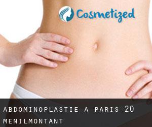 Abdominoplastie à Paris 20 Ménilmontant