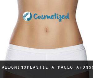 Abdominoplastie à Paulo Afonso