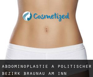 Abdominoplastie à Politischer Bezirk Braunau am Inn
