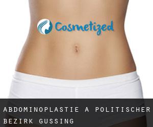 Abdominoplastie à Politischer Bezirk Güssing
