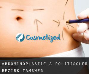 Abdominoplastie à Politischer Bezirk Tamsweg