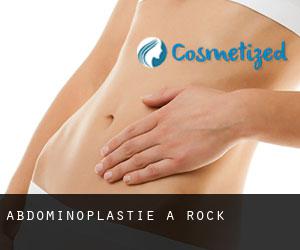 Abdominoplastie à Rock Abdominoplastie à Rock