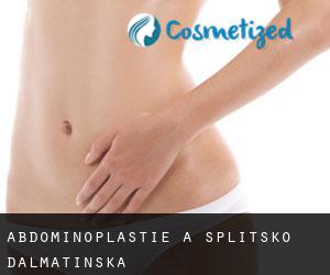 Abdominoplastie à Splitsko-Dalmatinska