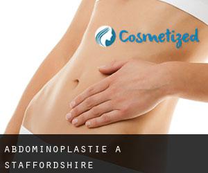 Abdominoplastie à Staffordshire Abdominoplastie à Staffordshire