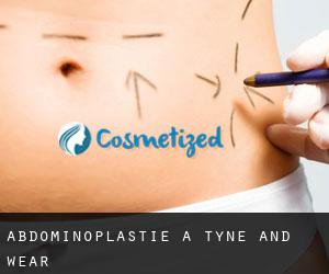 Abdominoplastie à Tyne and Wear