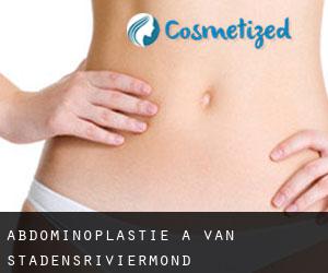 Abdominoplastie à Van Stadensriviermond