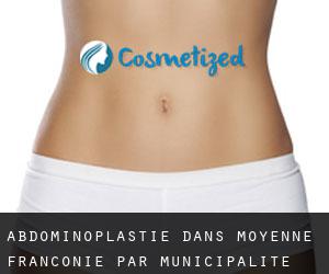 Abdominoplastie dans Moyenne-Franconie par municipalité - page 1
