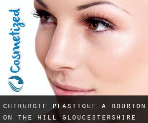chirurgie plastique à Bourton on the Hill (Gloucestershire, Angleterre)