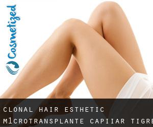 Clonal Hair Esthetic-M1Crotransplante Capiiar (Tigre)